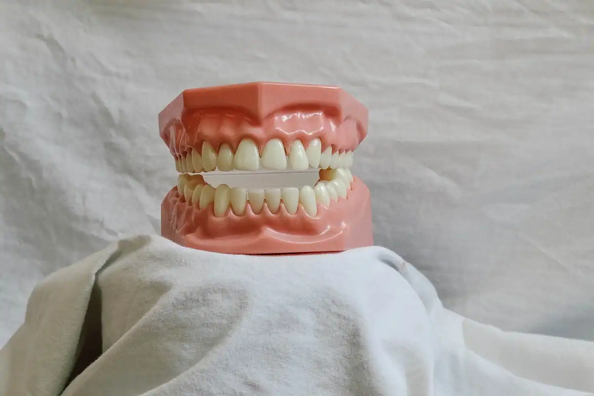 Model dentar cu dinți și molari, folosit pentru instruire în stomatologie