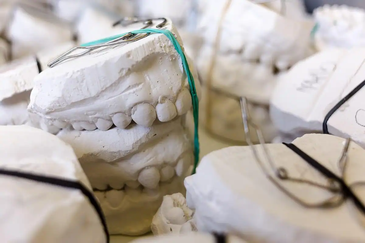 Modele dentare din ghips cu dinți aliniați, folosite în stomatologie și ortodonție